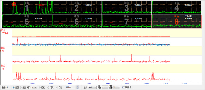 超聲掃描.jpg 超聲掃描.jpg